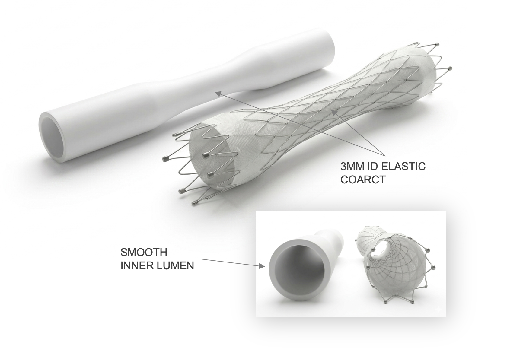 VascX devices with cross-section detail showing 3mm ID elastic coarct and smooth inner lumen